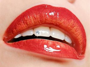 estetica dentara