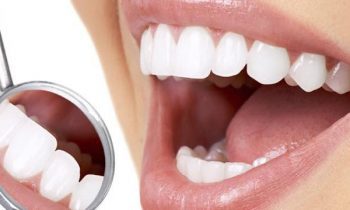 Estetica dentara